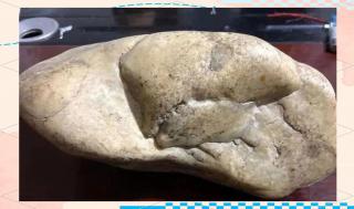 和田玉与石包玉的魅力与风险探秘